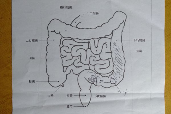 先生が描いた大腸のイラスト